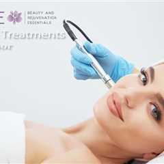 What can a microdermabrasion treatment do for my skin?