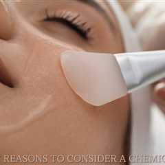 7 Reasons You Should Consider A Chemical Peel - Utopia Spa